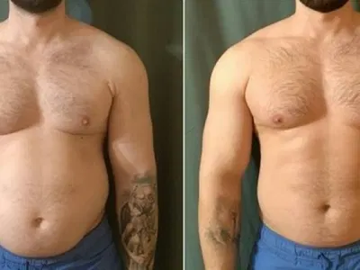 Customer transformation photo